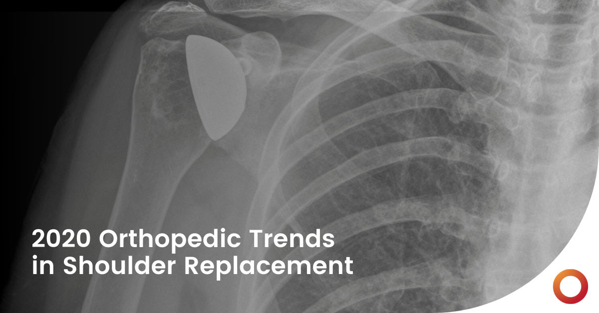 2020 Orthopedic Trends in Shoulder Replacement