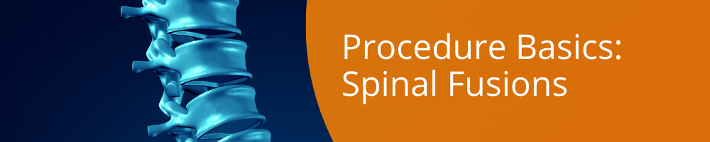 Spinal Fusions