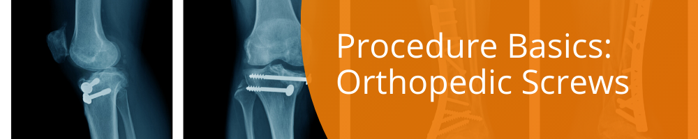 Orthopedic Screws
