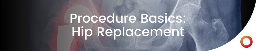 Hip Replacement